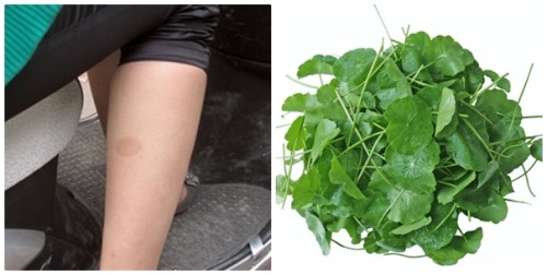 Tổng hợp các cách trị thâm sẹo hiệu quả cho từng loại da 1